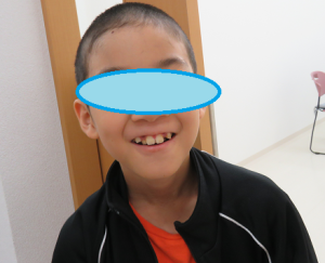 坊主頭の児童の写真